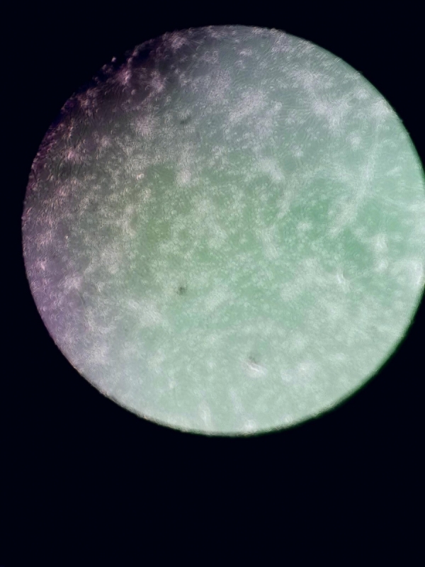 Photo of rat neurons 